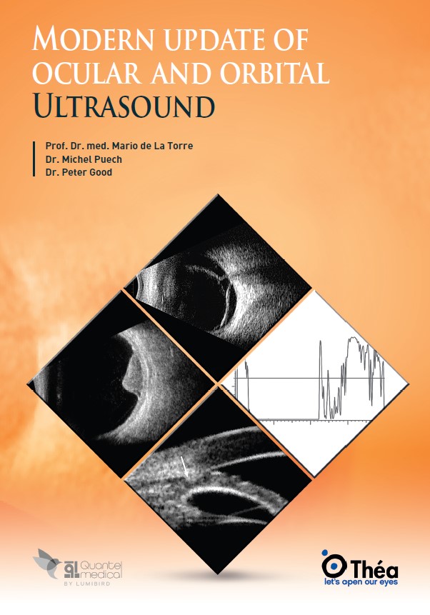 Modern update of ocular and orbital ultrasound