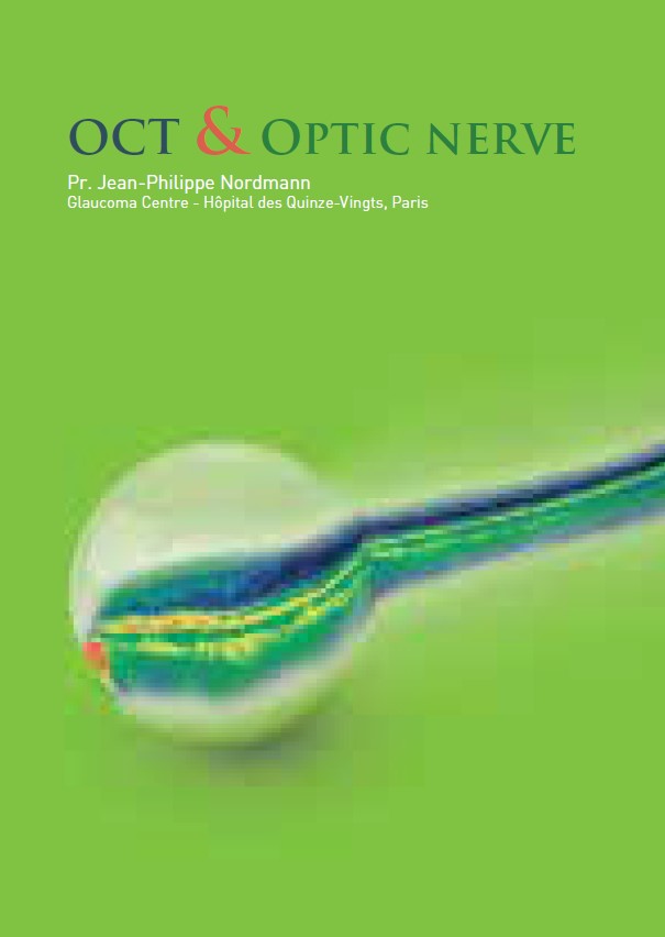 Oct & optic nerve