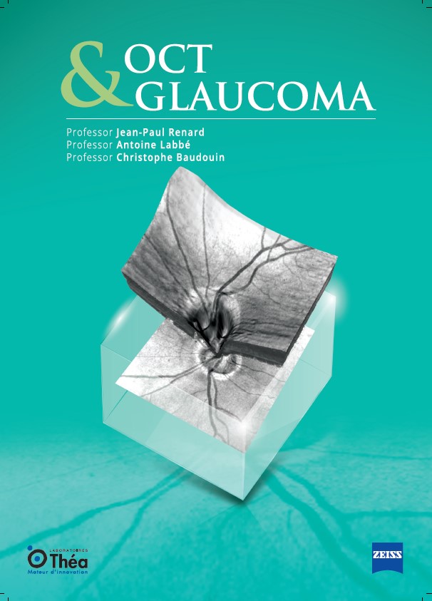 Oct & glaucoma