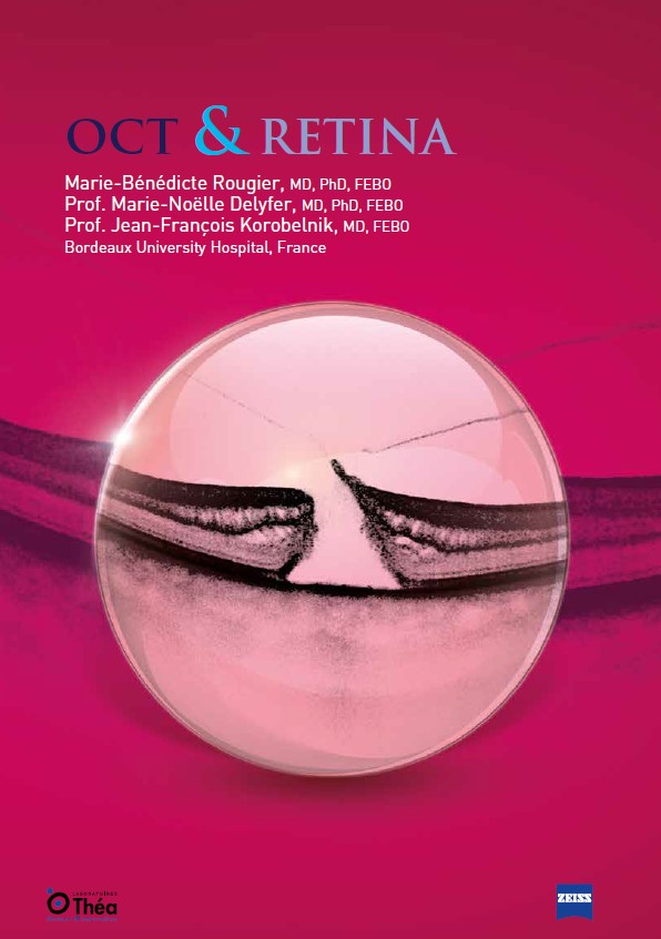 Oct & retina (deutsche version)