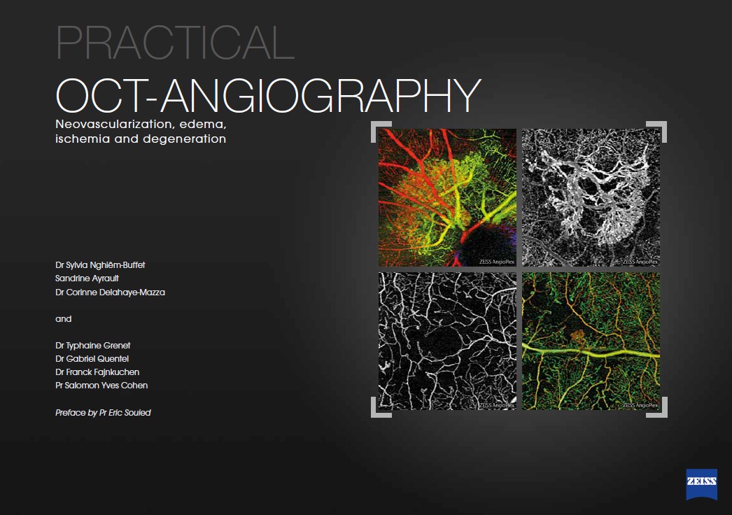 Practical oct-angiography