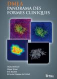 Amd – an overview of clinical forms