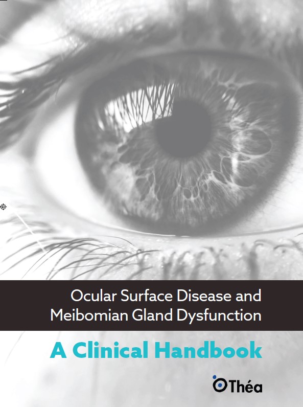 Ocular surface disease and meibomian gland dysfunction a clinical handbook
