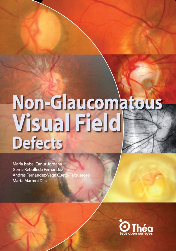 Non-glaucomatous visual field defects