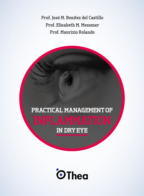 Practical management of inflammation in dry eye