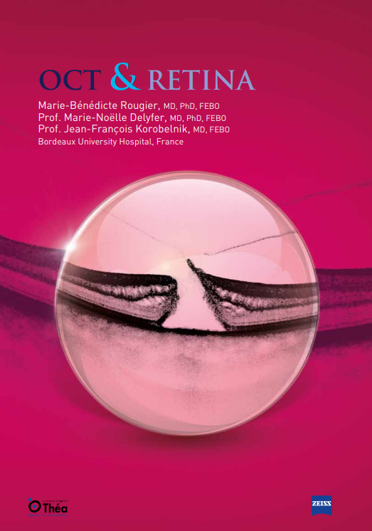 OCT and retina: a comprehensive guide to  a macular disease diagnostics