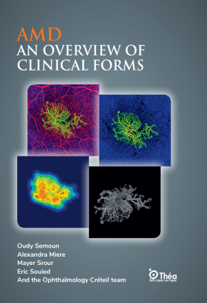 AMD an overview of clinical forms