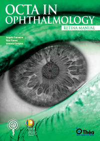 OCTA in ophthalmology