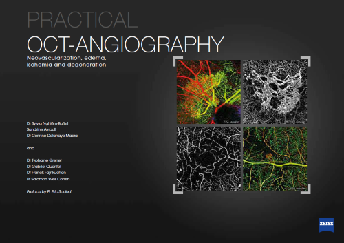 Practical OCT Angiography: a modern guide to retinal  imaging and clinical diagnosis