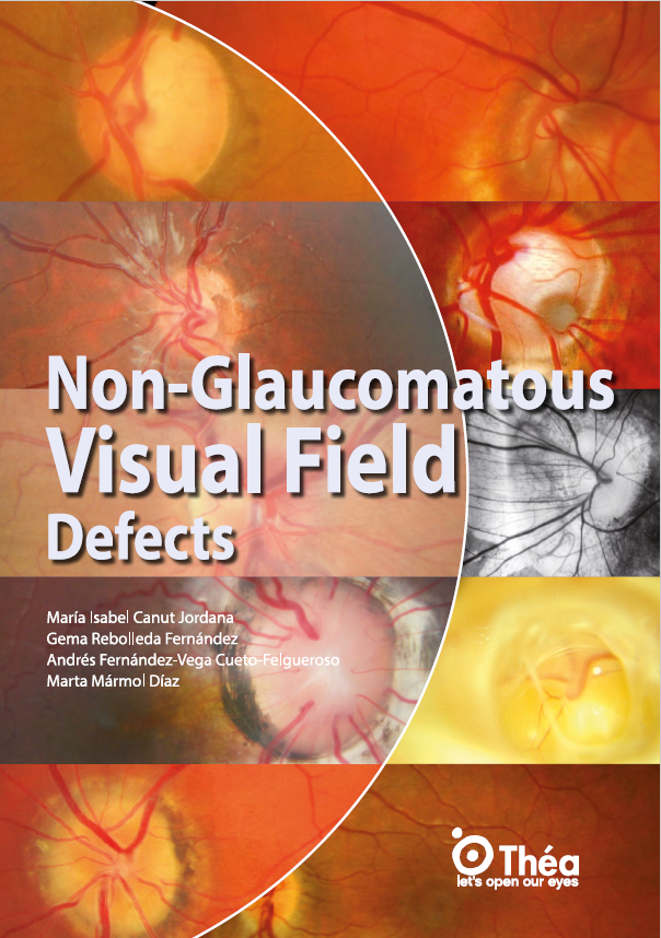 Non glaucomatous visual field defects