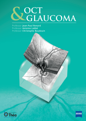 OCT and glaucoma: leveraging imaging for early diagnosis and management