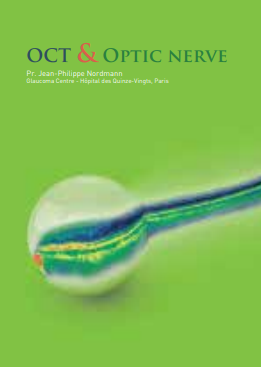 OCT and optic nerve: advancing neuro-ophthalmic imaging