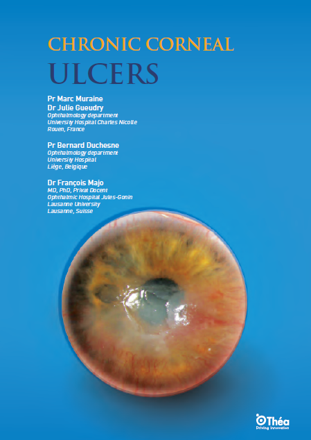 Chronic corneal ulcers: an in-depth review