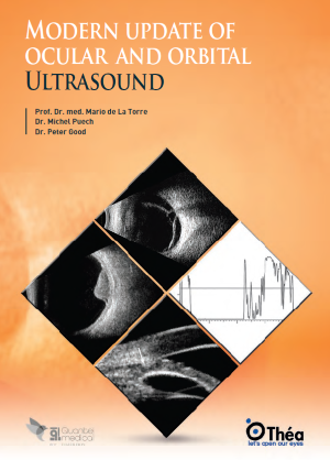Modern update of ocular and orbital ultrasound